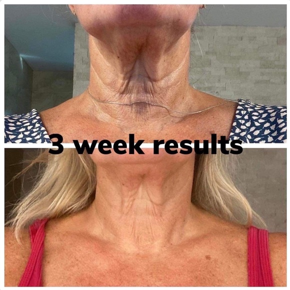 ageLOC® Dermatic Effects™ Body Contouring Lotion/Hibiscus Firming Cream - Picture 10 of 10